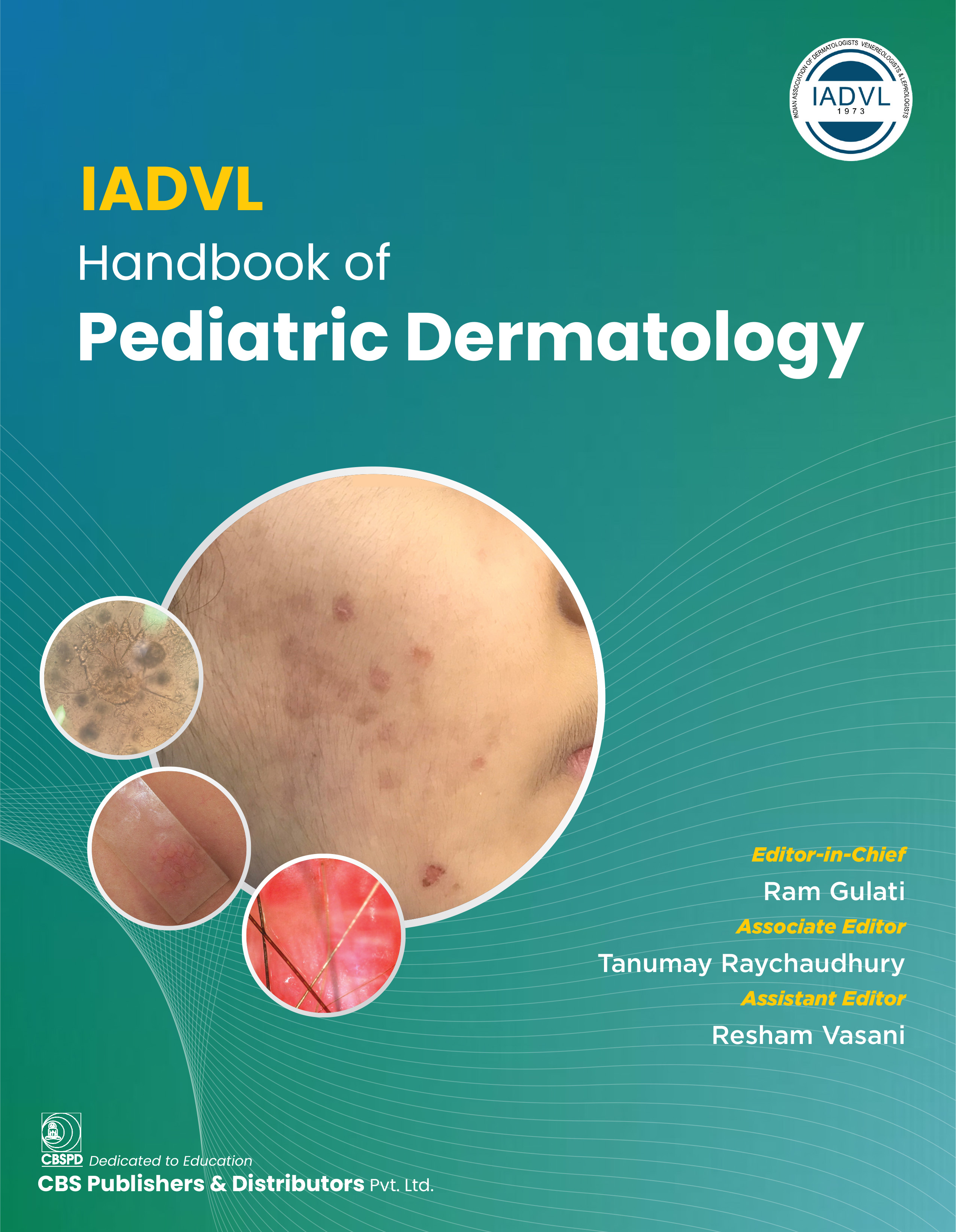 Iadvl handbook of pediatric dermatology
